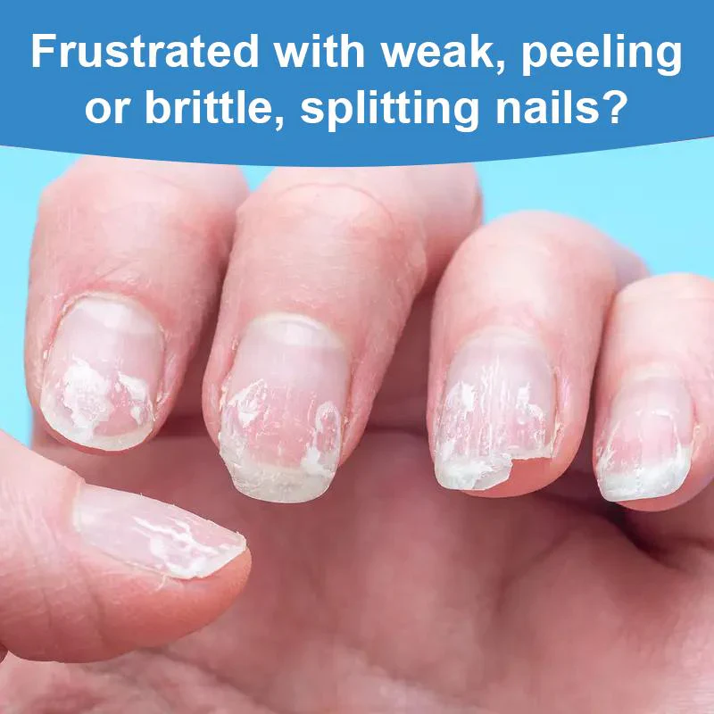 The 3-Day Nail Rescue - Keratin Power, Salon Shine, and Scratch-Proof + 50% OFF - Image 9