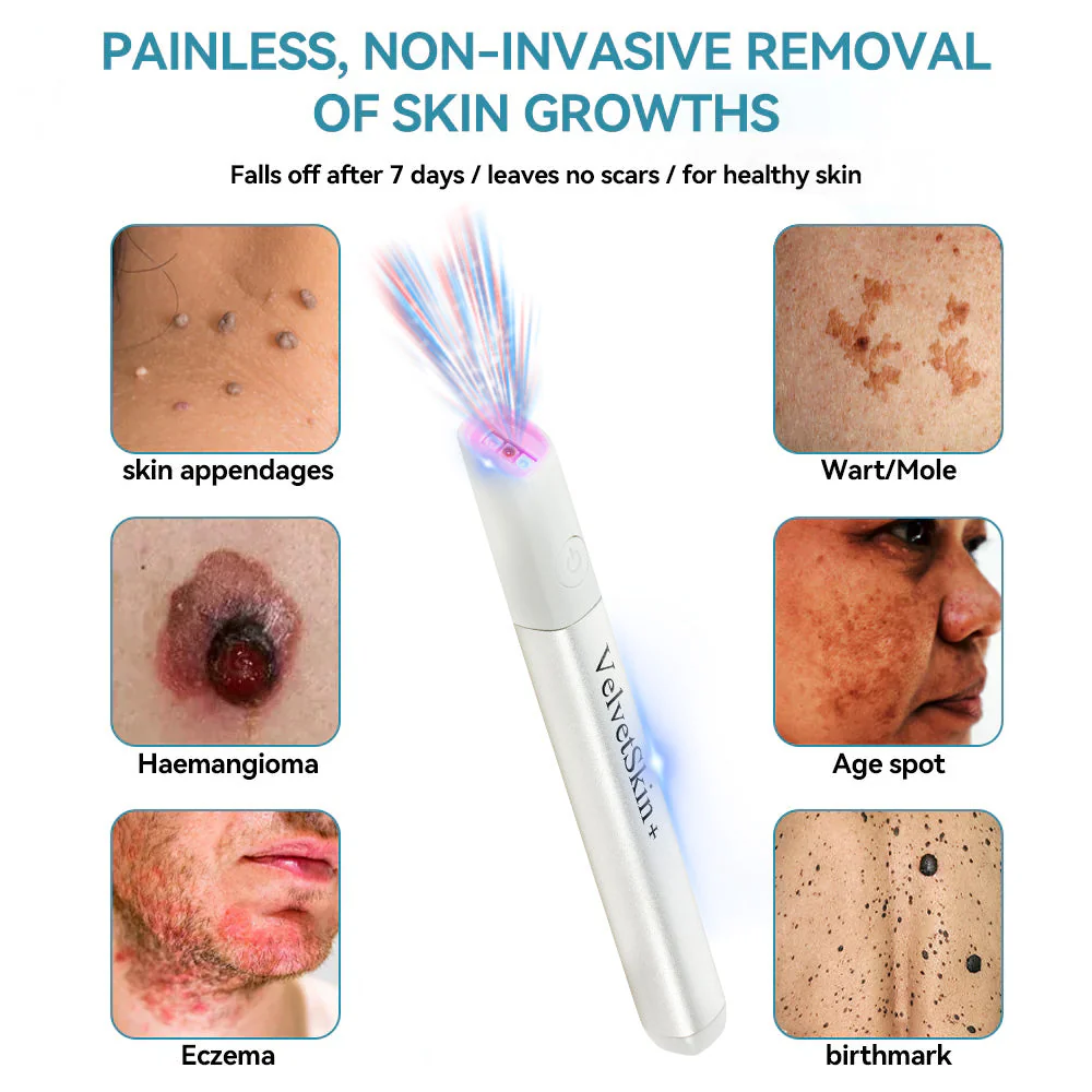 DermaBeam Pro – Erase Skin Flaws Instantly + 50% OFF - Image 10