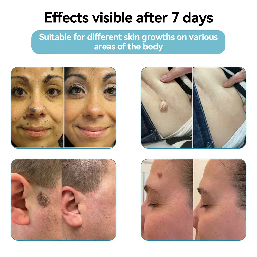 DermaBeam Pro – Erase Skin Flaws Instantly + 50% OFF - Image 11