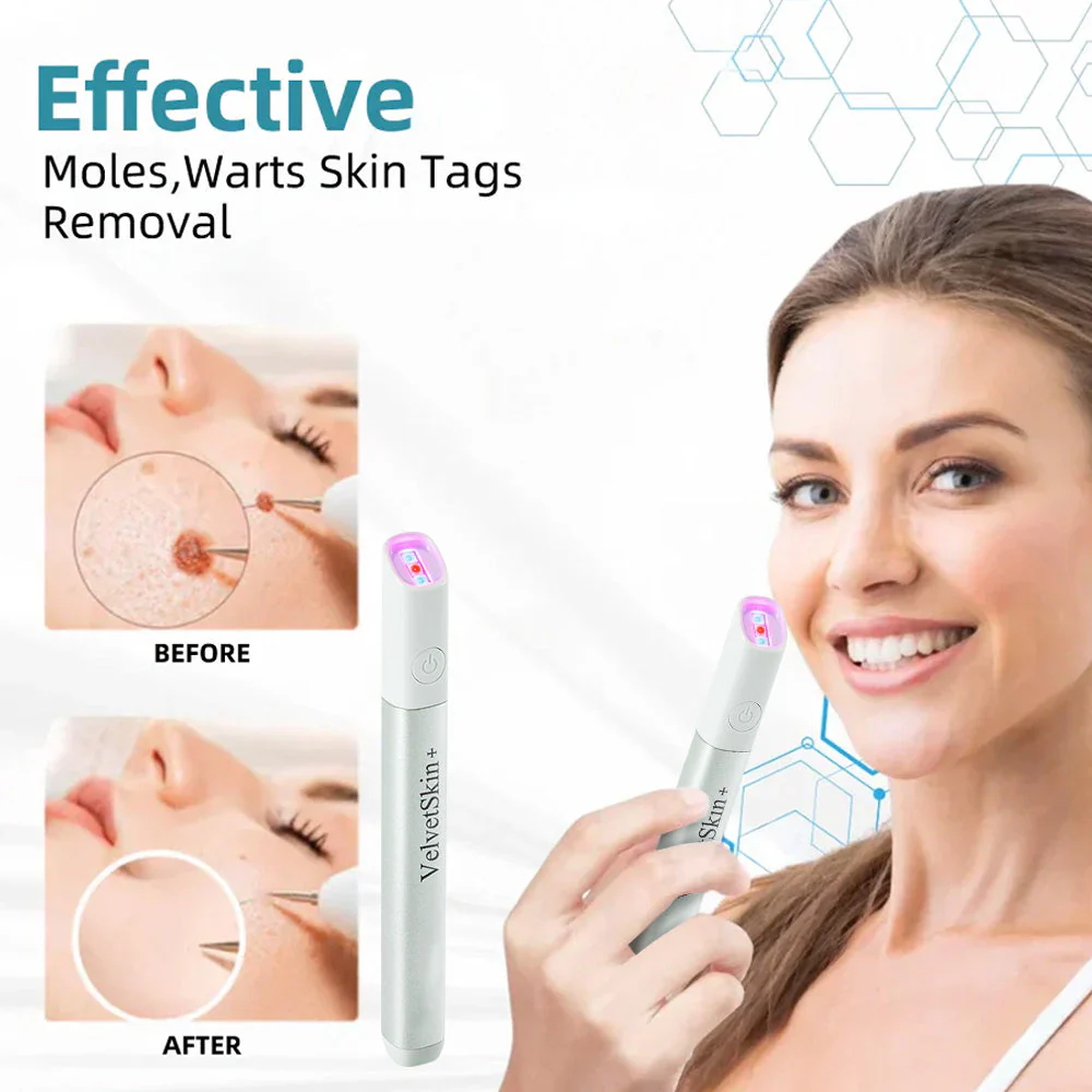 DermaBeam Pro – Erase Skin Flaws Instantly + 50% OFF - Image 5