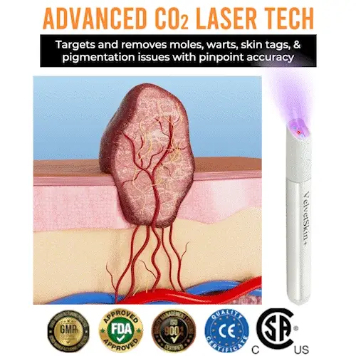 DermaBeam Pro – Erase Skin Flaws Instantly + 50% OFF - Image 7
