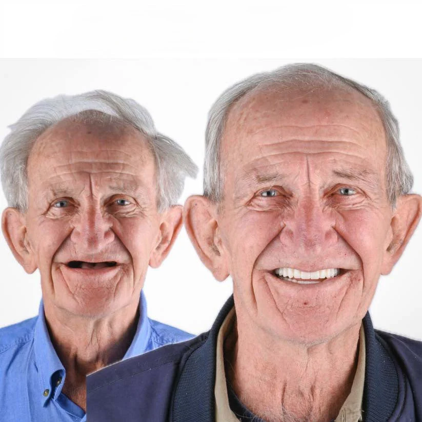 Pearlume™ – Custom-Fit Functional Dentures with Adaptive Gel Fit, No Adhesive Needed + 50% OFF - Image 9