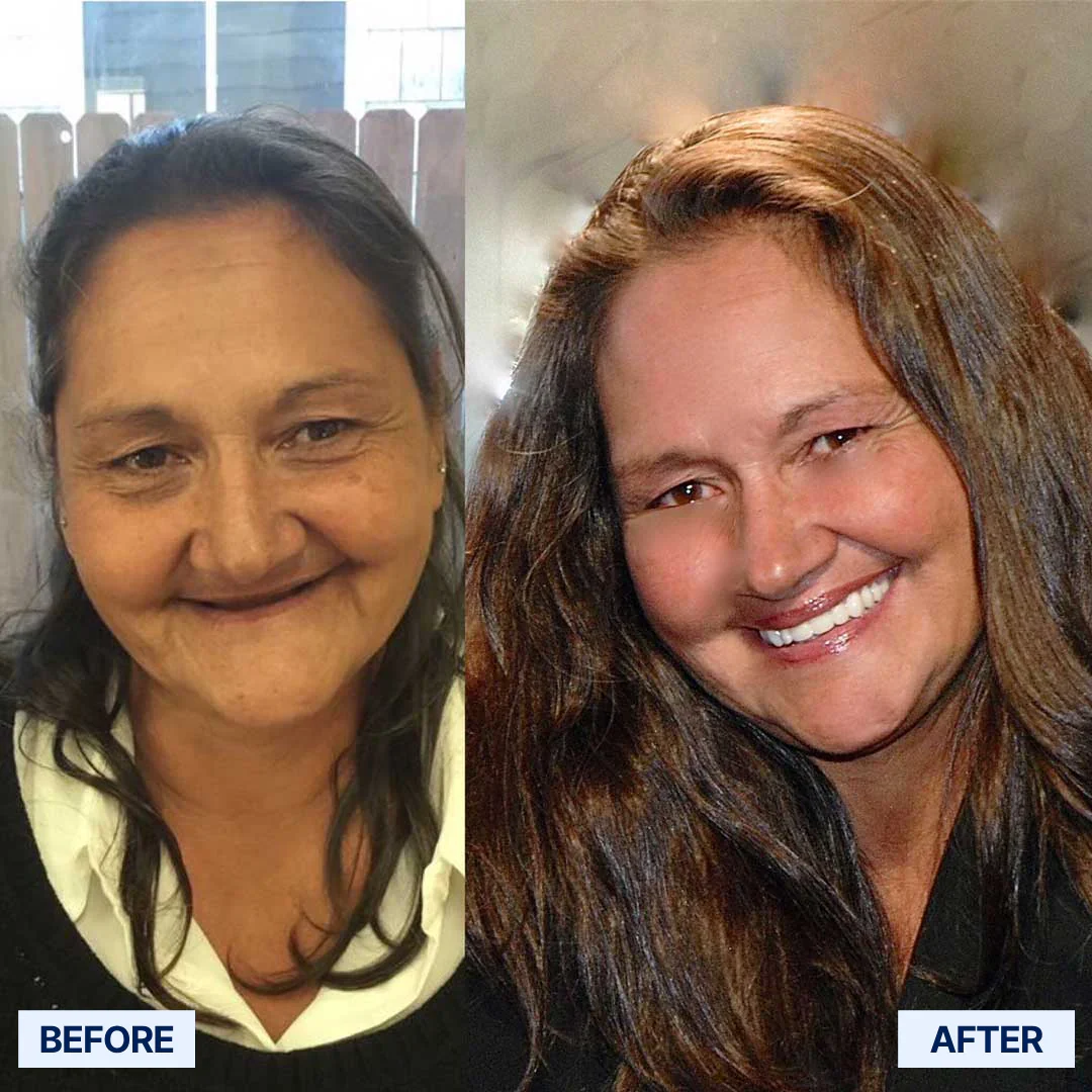 The Pro-Adaptive Dentures – Restore Your Smile, Enjoy Every Bite, and Live Confidently Again + 50% OFF - Image 8