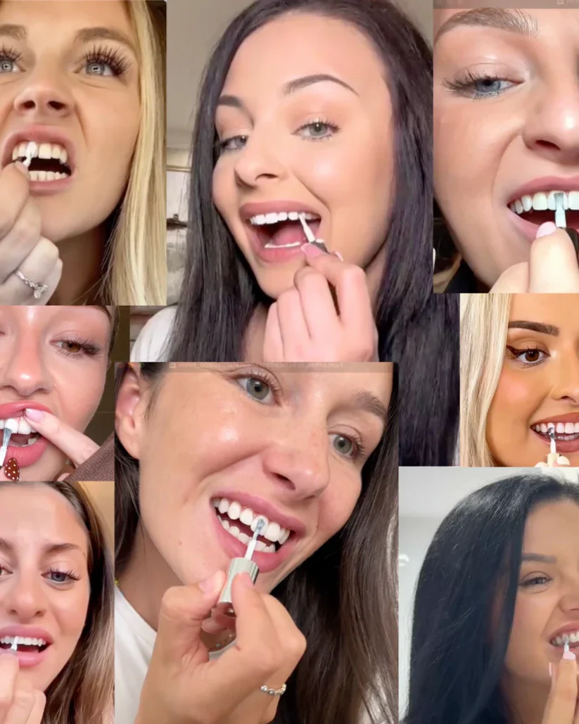 DentalGlow - Instant Radiance For Brighter, Smoother Enamel + 50% OFF - Image 8