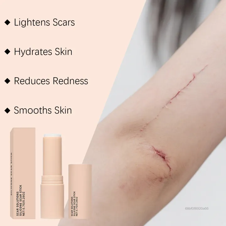 The AuraSmooth Scar Stick - 60% Medical-Grade Silicone, Centella Asiatica, and 100% Satisfaction Guarantee +50% OFF - Image 6