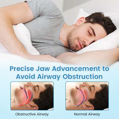 SilentRest™ Anti-Snoring & Anti-Grinding Teeth Protector - Image 12
