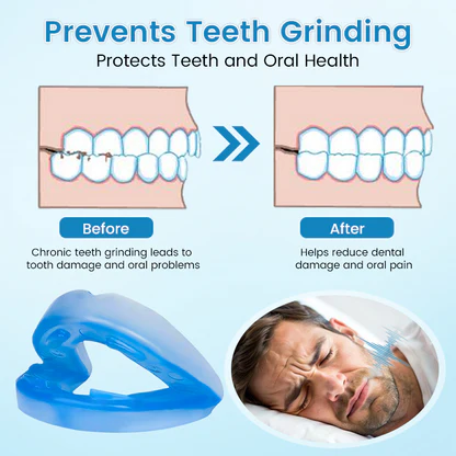 SilentRest™ Anti-Snoring & Anti-Grinding Teeth Protector - Image 2