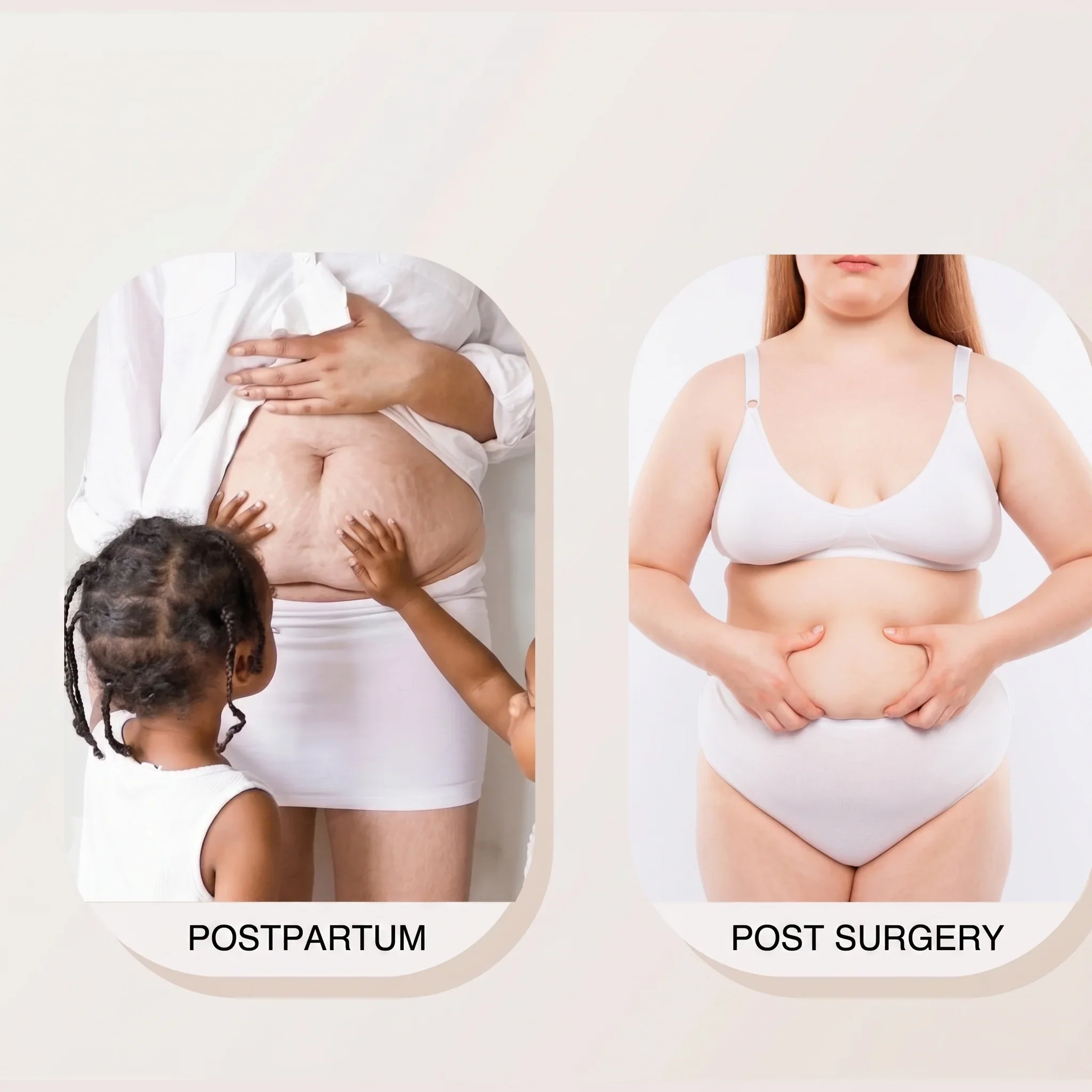 Poise™ – Dual-Zip Tummy Control Shapewear Bodysuit with Anti-Slip Lace + 50% OFF - Image 6