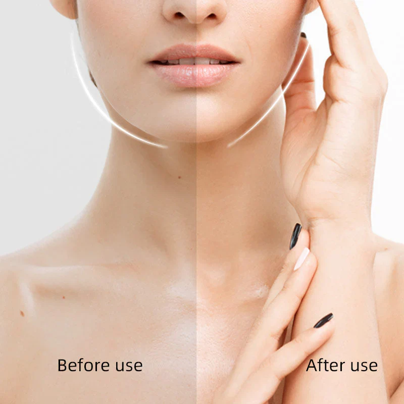V-Contour Secret - Look 10 Years Younger Instantly + Buy 1 Get 1 FREE - Image 17